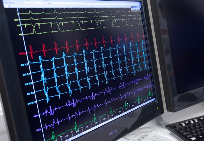 ECG on computer