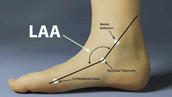 Medial Longitudinal Arch.jpg