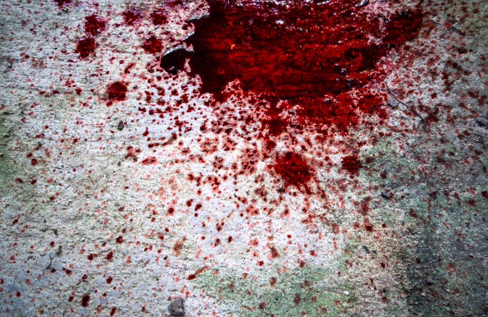 Your economic disengagement can cause this government to bleed out fiscally