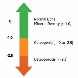 DEXA Scan - Scores & Everything You Need to Know | AlgaeCal