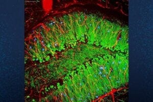 This scan of a mouse brain shows blood vessels (red), brain cells (green), and amyloid plaques (blue). A new gene therapy treatment developed by UC San Diego works by reprogramming the behavior of diseased brain cells.