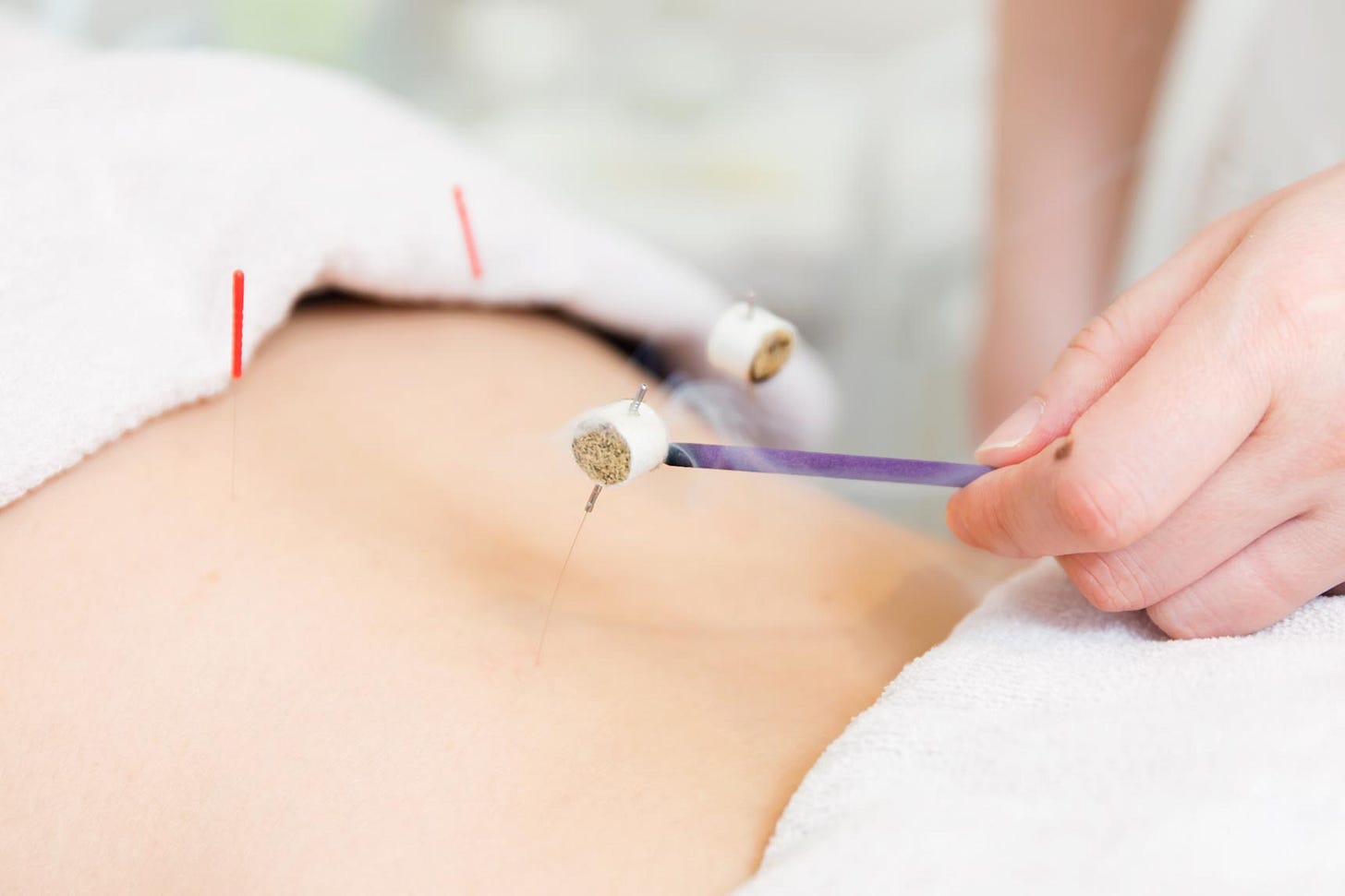 不妊鍼灸はriccaにお任せください | 不妊鍼灸は鍼灸サロンRicca【東京・白金】