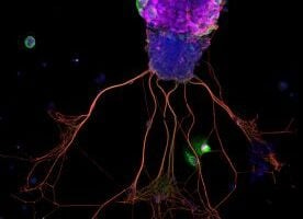 A representative picture of an organoid grown by Brian Lin and team--in fact, the researchers said, it was the first one they ever saw.
