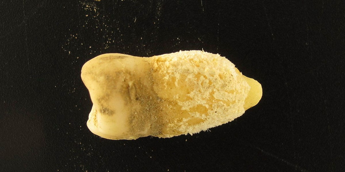 A Tooth from a Chullpa Rewrites the History of Strep