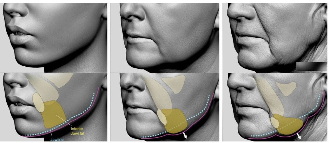 flacidez facial, jowl