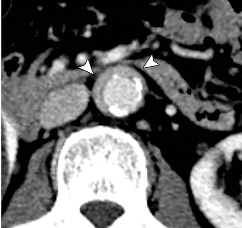 Figure 2b.