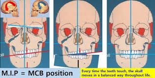 The reason my face keeps changing Most people have asymmetry in their skulls. If the lower jaw is in a distorted position, the asymmetry becomes more and more distorted as time passes The reason my face keeps changing Most people have asymmetry in their skulls. If the lower jaw is in a distorted position, the asymmetry becomes more and more distorted as time passes