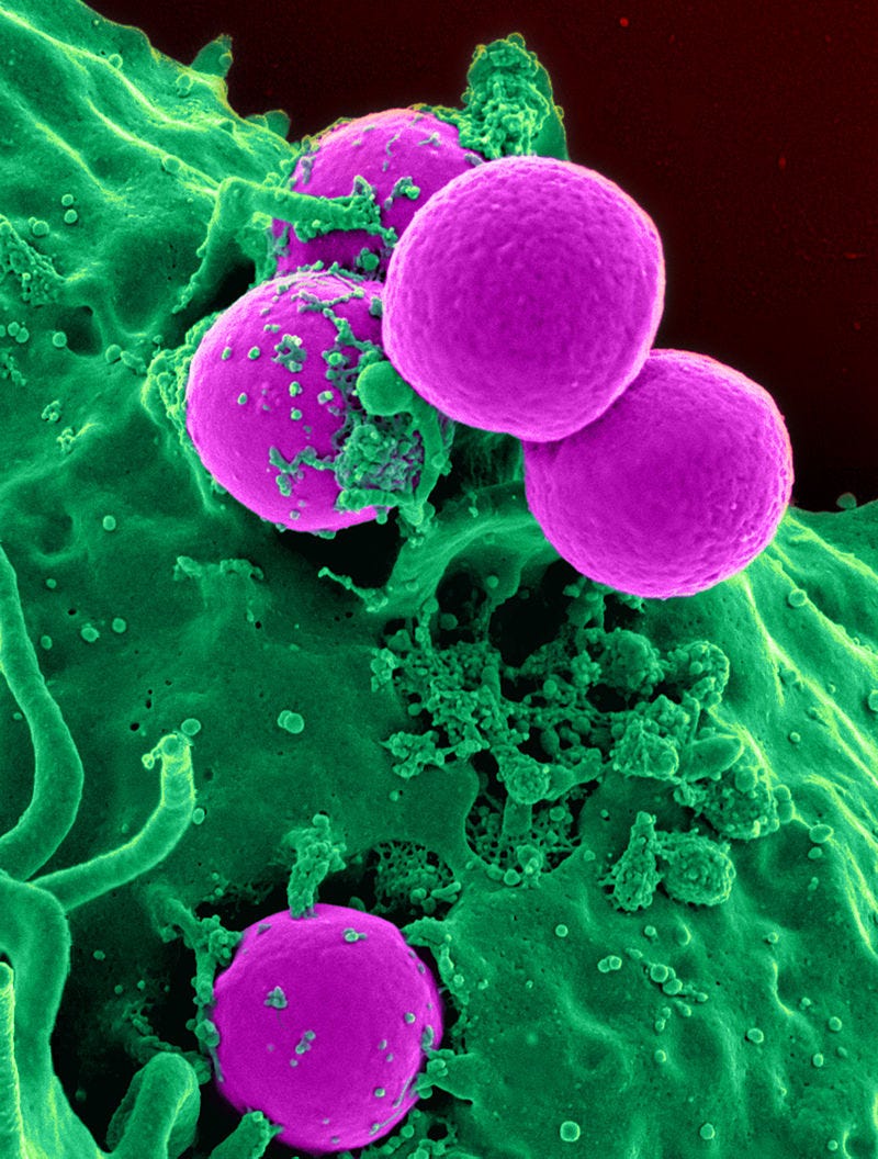 Scanning electron micrograph of a human neutrophil ingesting MRSA Scanning electron micrograph of a human neutrophil ingesting MRSA
