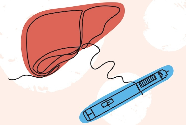 Medical research illustration with semaglutide injector and liver