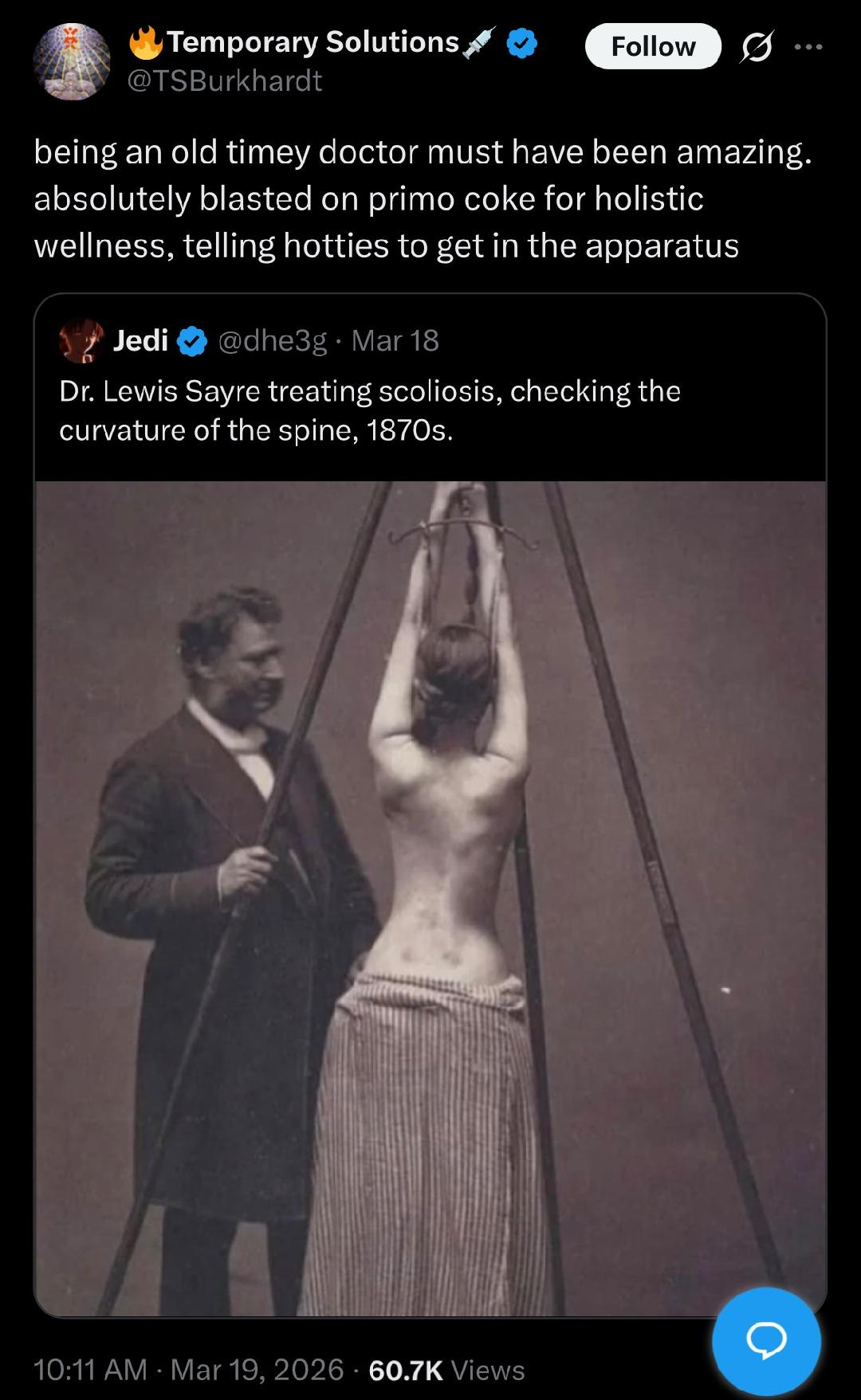 Pic of Dr. Lewis Sayre treating scoliosis by checking curvature of the spine, 1870s, which involves him standing in front of a topless woman (we see from the back) with her arms hoisted above her head by a rope like she's being tried for witchcraft. Quote tweeted "being an old timey doctor must have been amazing. absolutely blasted on primo cocaine for holistic wellness, telling hotties to get in the apparatus"