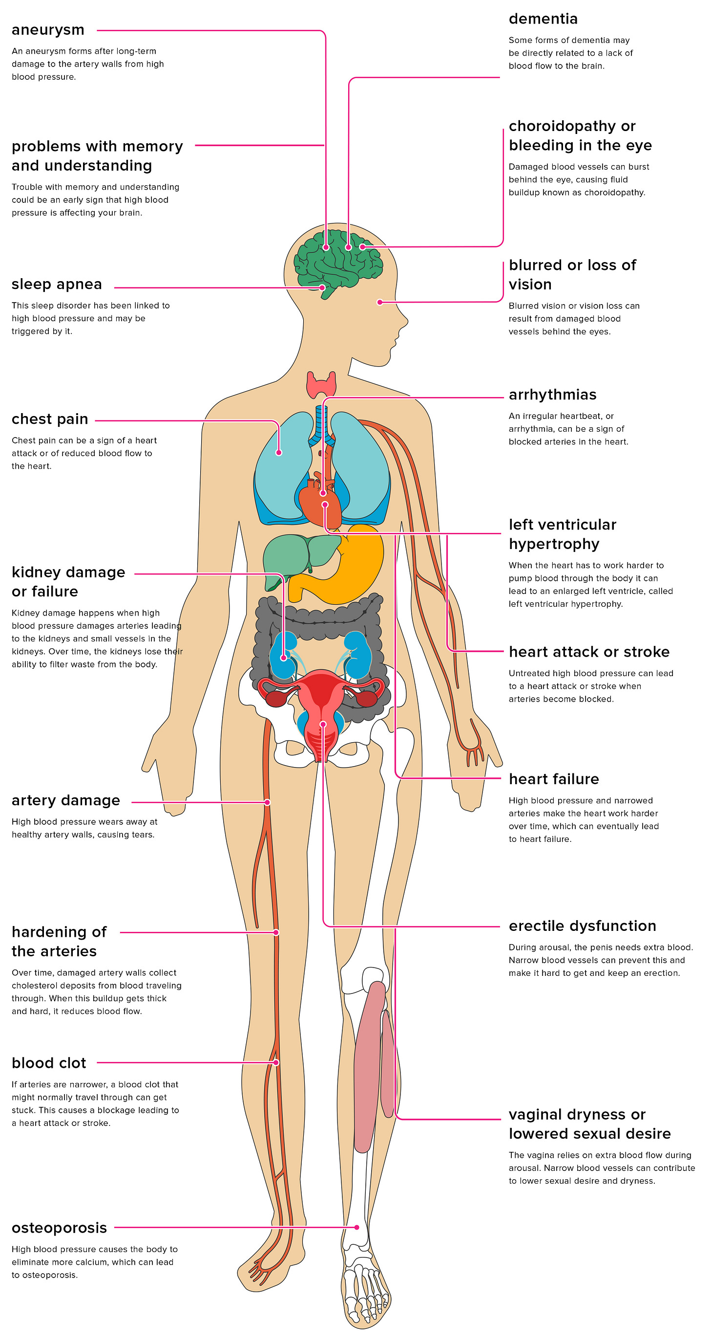 The Effects of Hypertension on the Body The Effects of Hypertension on the Body