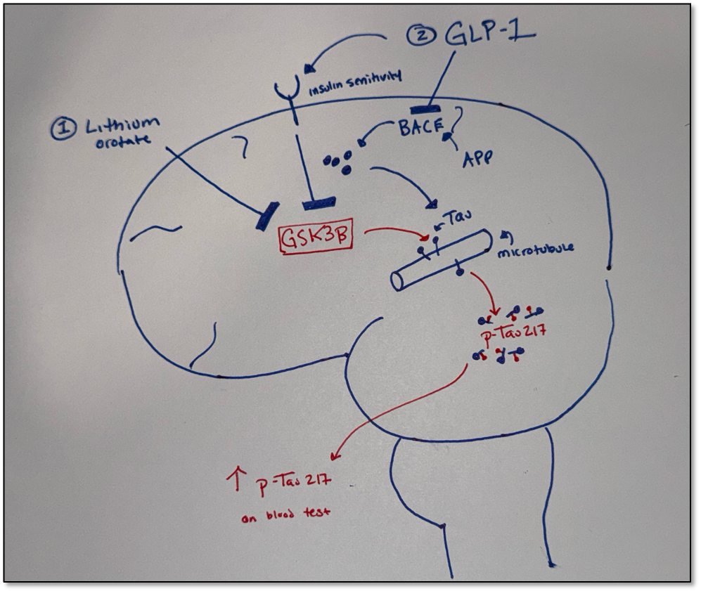 The First Smoke Detector for Alzheimer's Disease