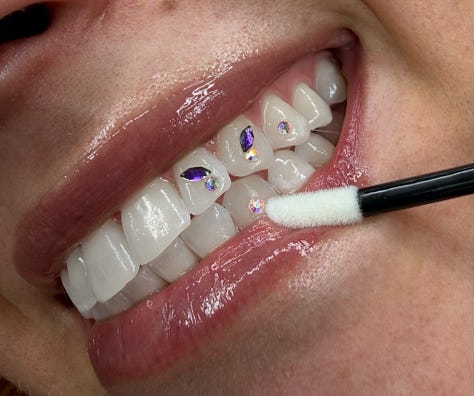 tooth gems italy milan kola payer