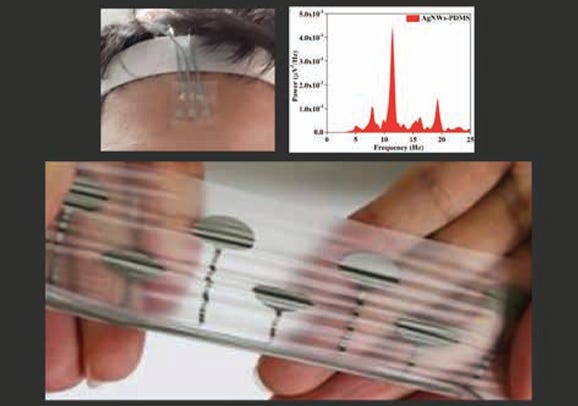 Implantable Electrocorticography (ECoG) Probes for Neuro-Surgery and NeuroMonitoring