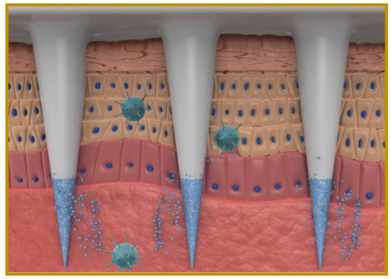 This Microneedle Patch Implant (MPI) is very troubling for mankind ...