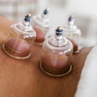 Cupping for Healing and Cell re-generation
