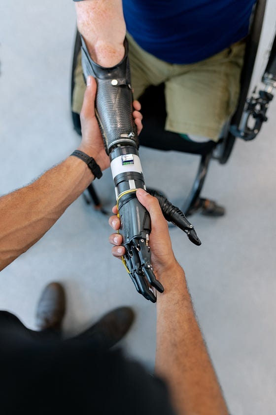 A man using a prosthetic hand to shake hands with another person A man using a prosthetic hand to shake hands with another person