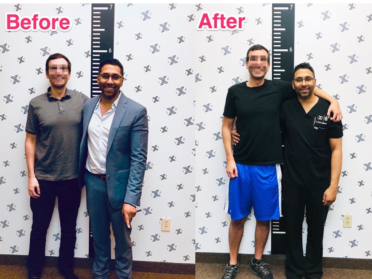 Men Are Paying $76,000 for a Limb-Extending Surgery to Be Taller - Business Insider Men Are Paying $76,000 for a Limb-Extending Surgery to Be Taller - Business Insider