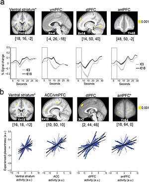 MRI scans