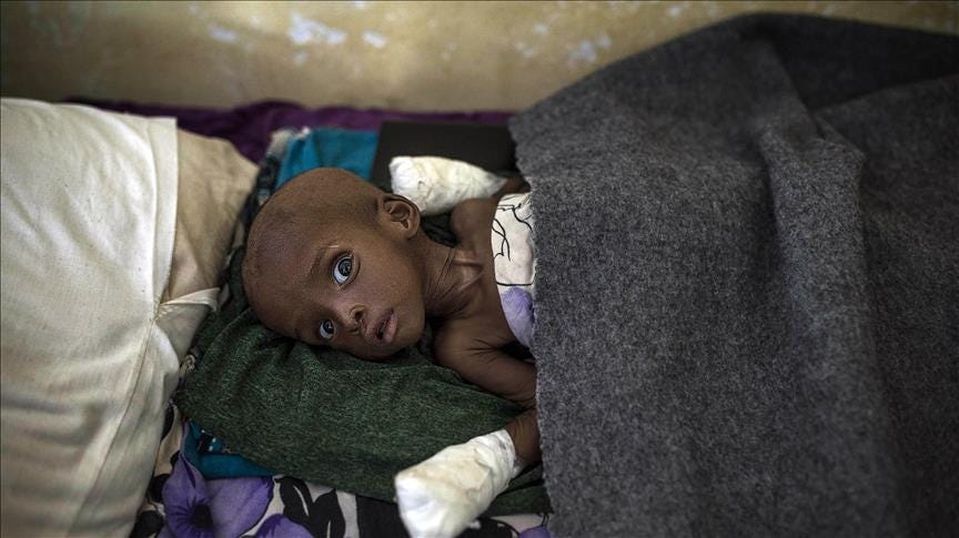 400,000 Congolese children risk starvation, UNICEF says