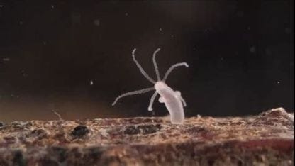 Doctor Carrie Madej on Hydra vulgaris, nanobots, and graphene oxide found in vaccination vials