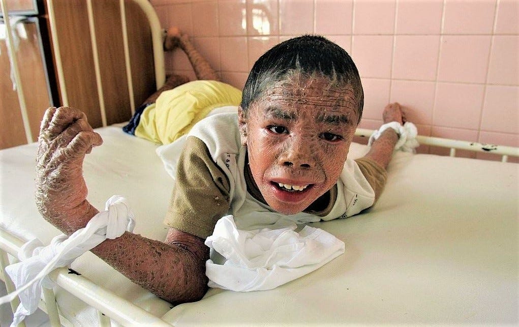 Agent Orange Victims: Haunting Photos Of The Unpunished War Crimes Of U.S. In Vietnam War Agent Orange Victims: Haunting Photos Of The Unpunished War Crimes Of U.S. In Vietnam War