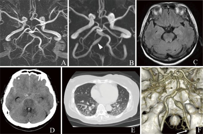 An external file that holds a picture, illustration, etc.
Object name is 2188-4226-9-0095-g001.jpg