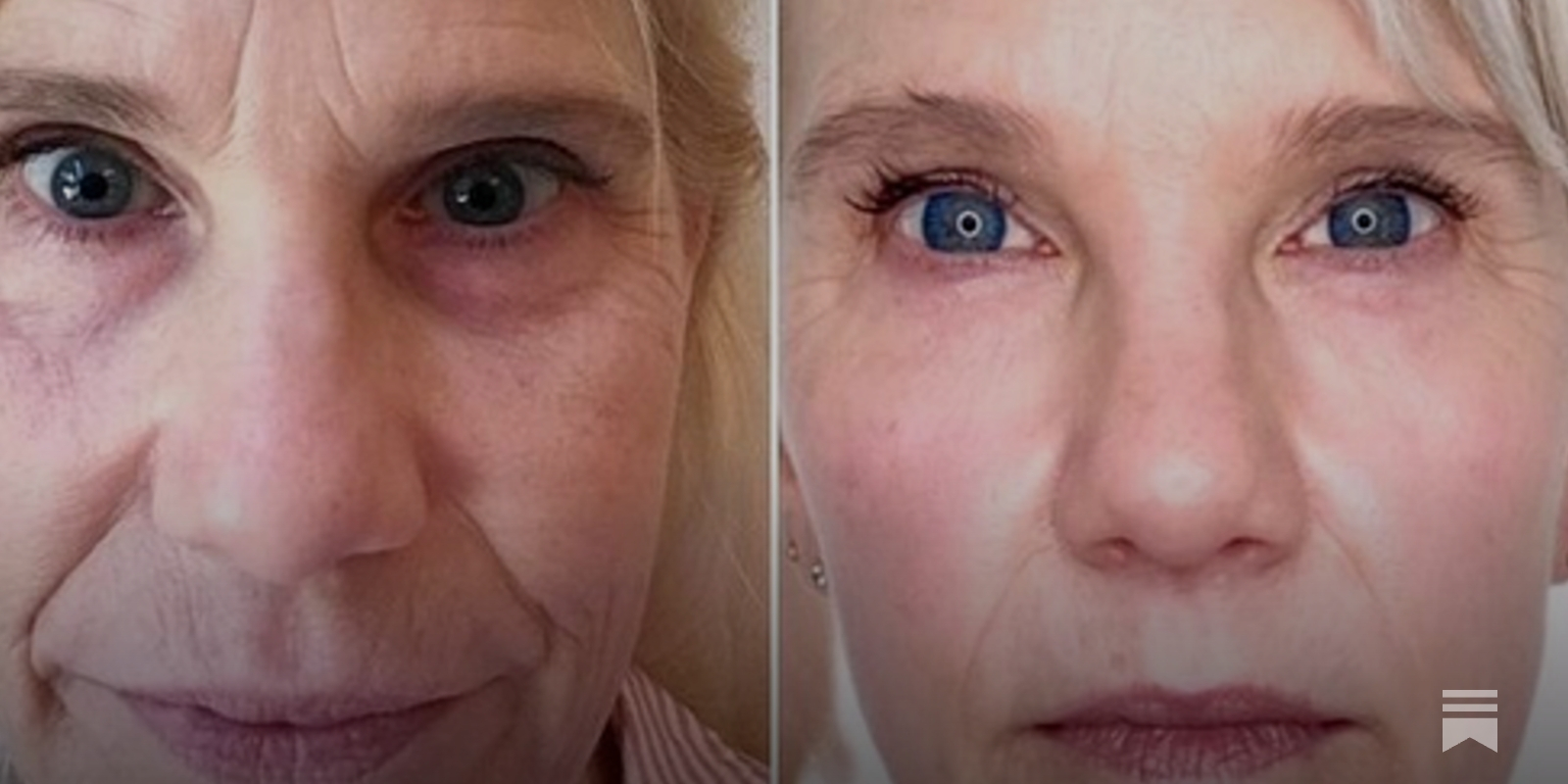 How does she look so good? Ask Cindy from Beyond50Skin!