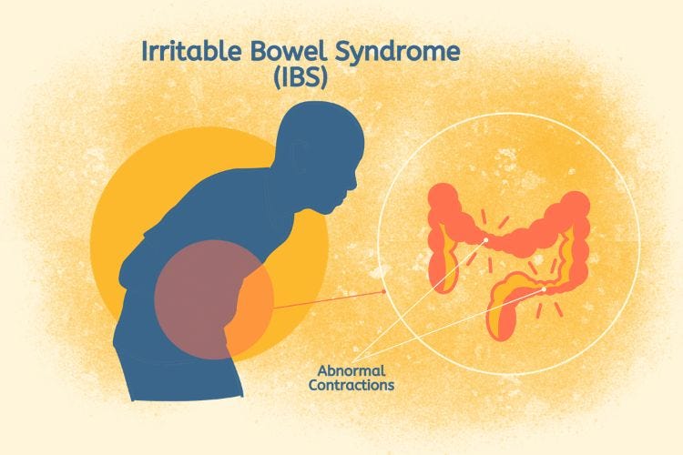 Irritable Bowel Syndrome (IBS)