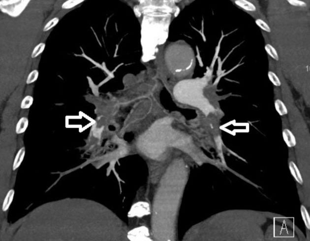 An external file that holds a picture, illustration, etc.
Object name is acs-38-539-g001.jpg