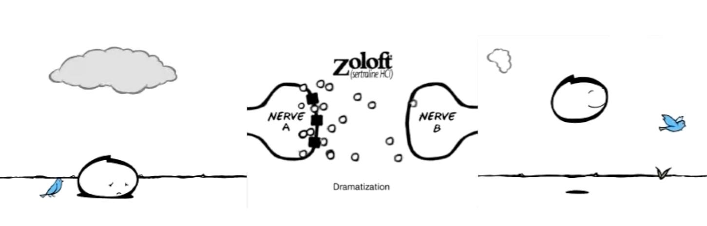 Three sequencial screenshots from the 2001 Zoloft advert showing from left to right: First, a line drawned blob with a sad expression with a grey cloud overhead and a blue bird on the ground next to it. Second,a representation of the Chemical Imbalance. The blue Zoloft logo and the text "Dramatization" are shown with two bumps, the nerve ends. A group of tiny serotonin dots float around the surface of Nerve A (left) and Nerve B (right). Black squares on Nerve A block the reuptake of the dots.Third, the blob bounces in the air and away, smiling with the flying blue bird. Three sequencial screenshots from the 2001 Zoloft advert showing from left to right: First, a line drawned blob with a sad expression with a grey cloud overhead and a blue bird on the ground next to it. Second,a representation of the Chemical Imbalance. The blue Zoloft logo and the text "Dramatization" are shown with two bumps, the nerve ends. A group of tiny serotonin dots float around the surface of Nerve A (left) and Nerve B (right). Black squares on Nerve A block the reuptake of the dots.Third, the blob bounces in the air and away, smiling with the flying blue bird.