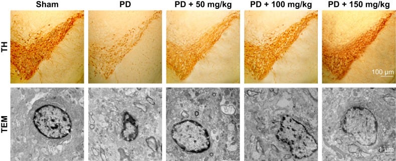 An external file that holds a picture, illustration, etc.
Object name is NDT-15-3615-g0004.jpg