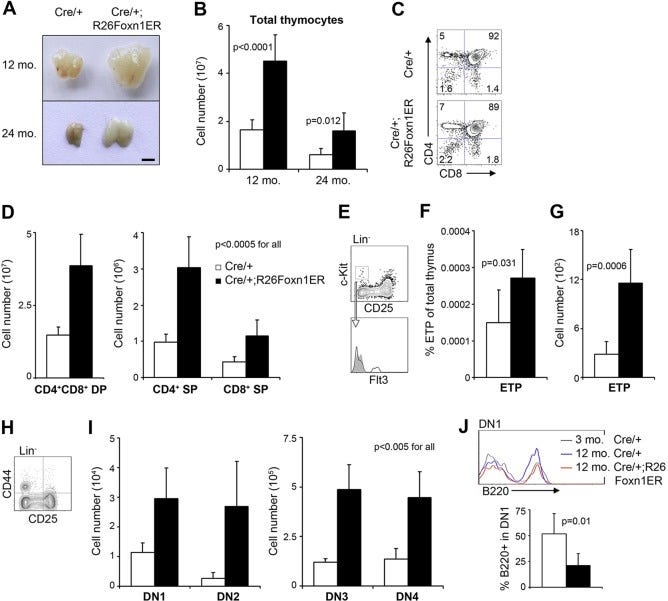 FOXN1 drives aged thymus regeneration FOXN1 drives aged thymus regeneration