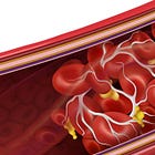 Complete blood count in vaxxed patients