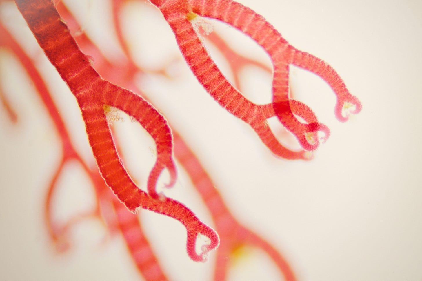 File:Ceramium, red algae (Rhodophyta).jpg - Wikimedia Commons
