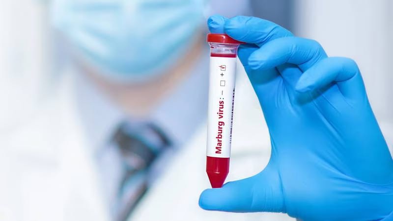 PSYOP-23: Seeding Marburg Virus As The Next Global "Pandemic" 