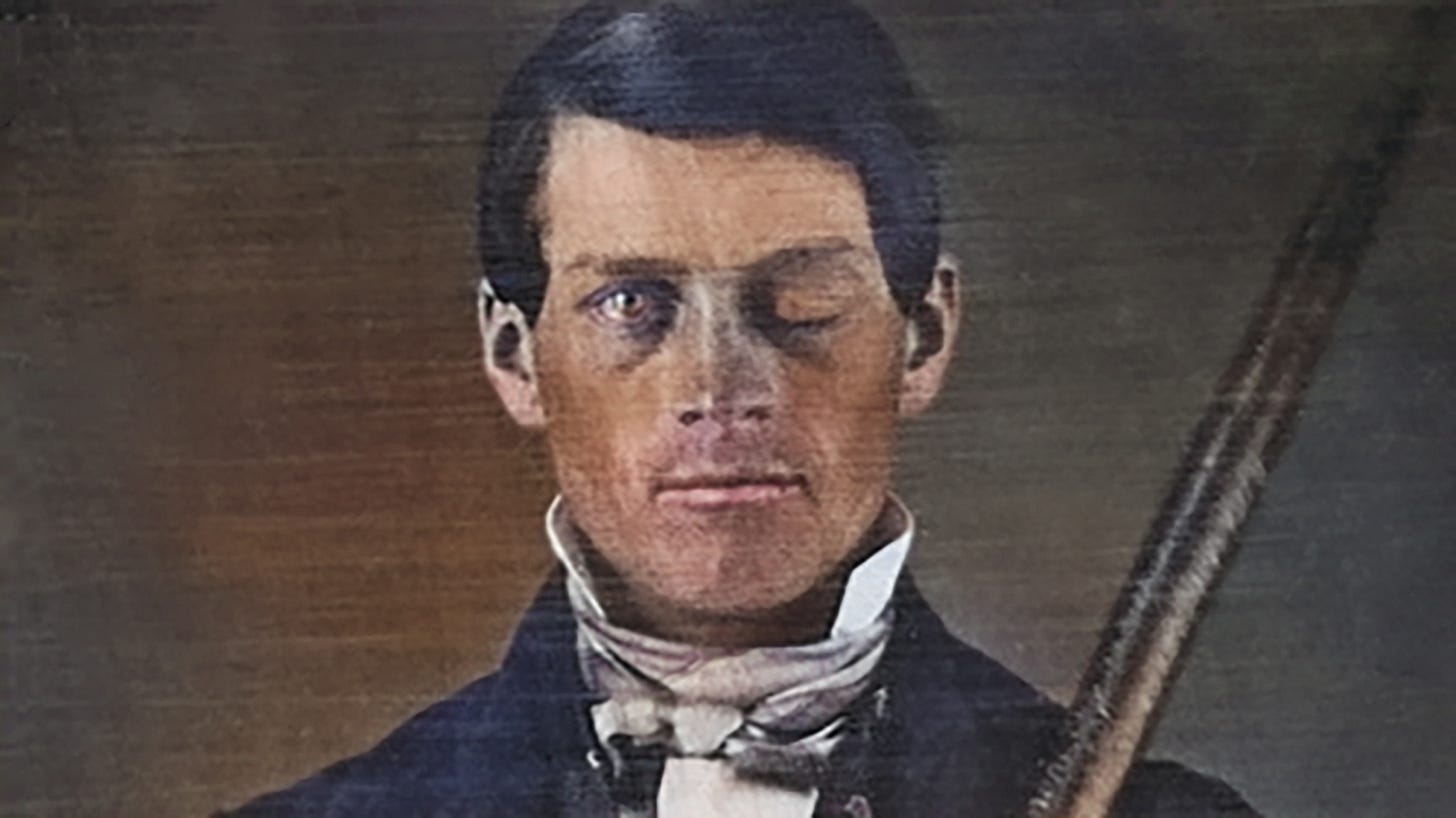 How did Phineas Gage survive an iron rod shooting through his brain? | Sky  HISTORY TV Channel