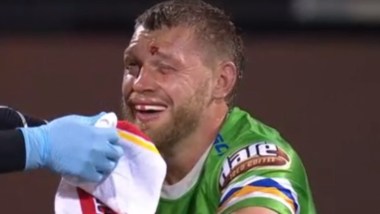 Injuries galore in Canberra Raiders shock thriller against St George Illawarra Dragons | news.com.au — Australia's leading news site Injuries galore in Canberra Raiders shock thriller against St George Illawarra Dragons | news.com.au — Australia's leading news site
