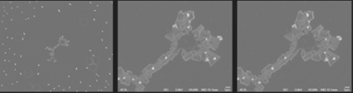 Electron Microscopy Of The Blood Of A 43 Year Old With 3 Pfizer ...