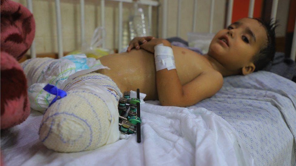 Wounded child, no surviving family': The pain of Gaza's orphans - BBC News
