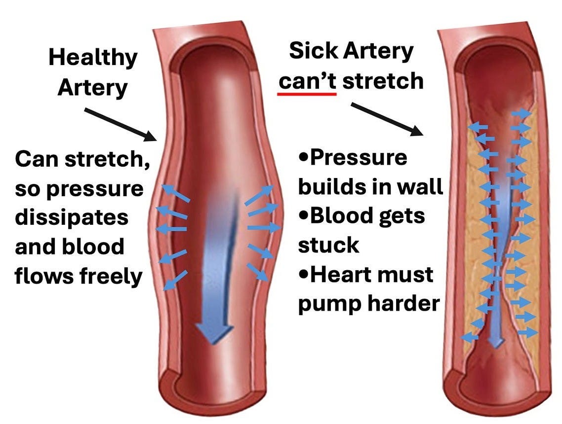 Blood Pressure — Understanding Blood Pressure in a Healthy Way. Blood Pressure — Understanding Blood Pressure in a Healthy Way.