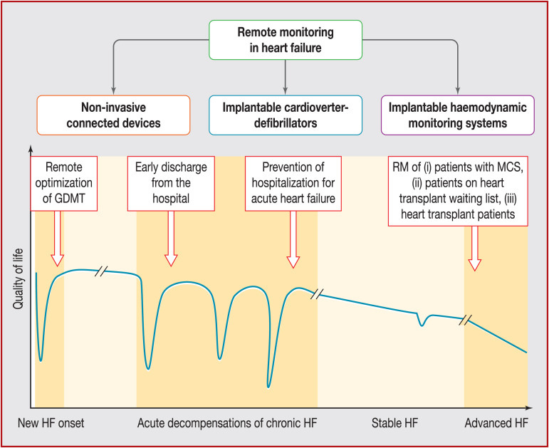 Remote management in patients with heart failure (from new onset to advanced): A practical guide - ScienceDirect Remote management in patients with heart failure (from new onset to advanced): A practical guide - ScienceDirect