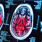 Neuroplasticity: Rewiring Your Brain To Do Hard Things