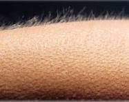 Por que ficamos arrepiados? | Super