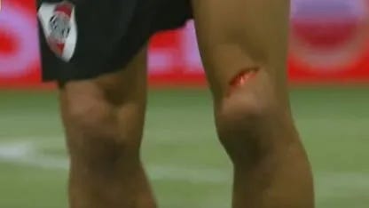 River y la maldición del 5 ante Palmeiras: se lesionó Portillo y Enzo Pérez  sufrió un tremendo corte - TyC Sports