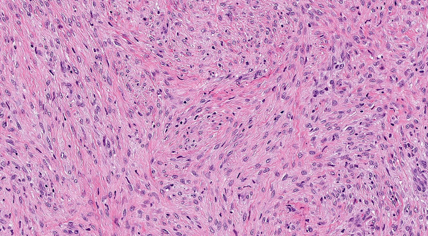 Fascicular arrangement Fascicular arrangement