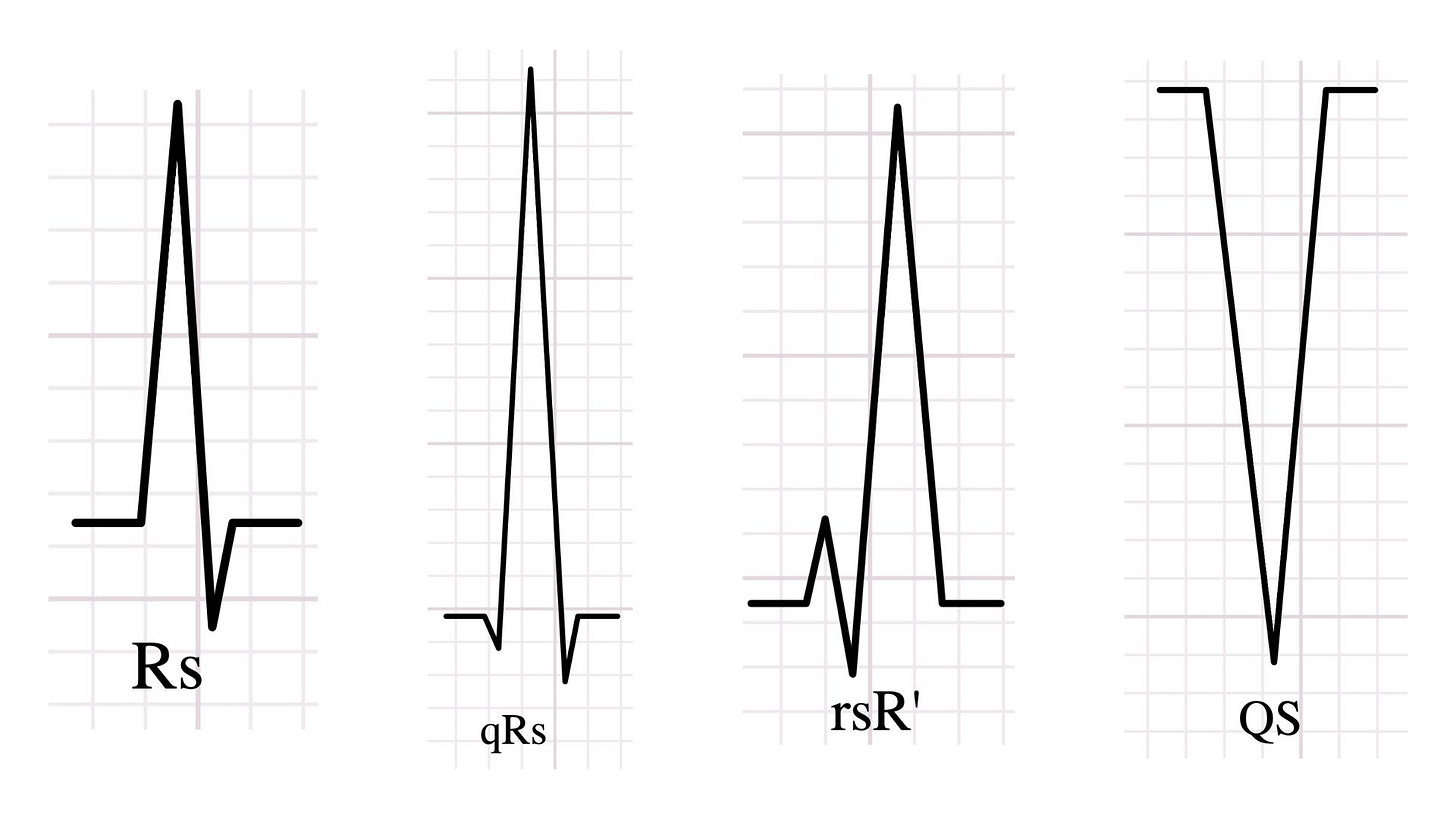 Four QRS complex examples labelled Rs, qRs, rsR', and QS, demonstrating standard QRS nomenclature