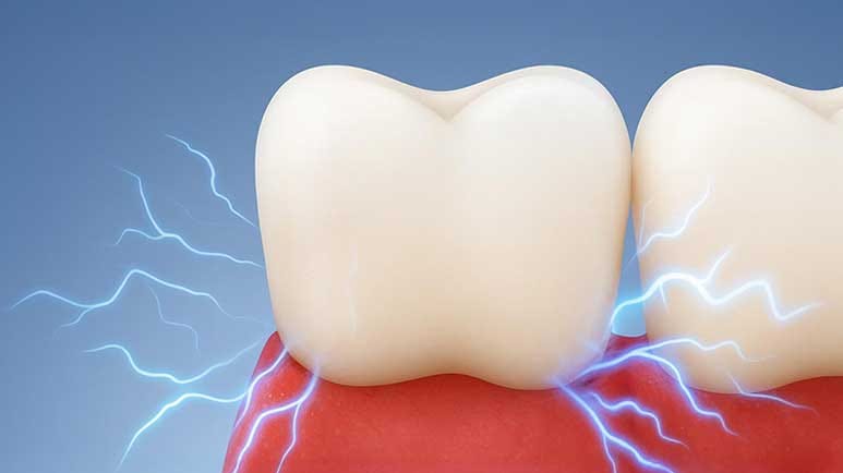 tooth sensitivity causes and remedies