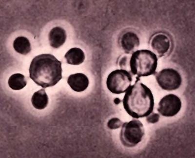 Paracoccidioides brasiliensis, cause of paracoccidioidomycosis, aka South  American Blastomycosis, Brazilian Blastomycosis Tom Volk's Fungus of the  Month for January 2005