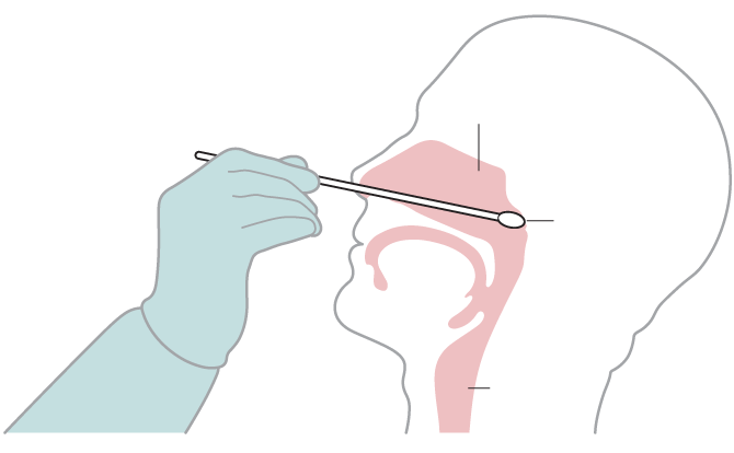 Nasopharyngeal Swab